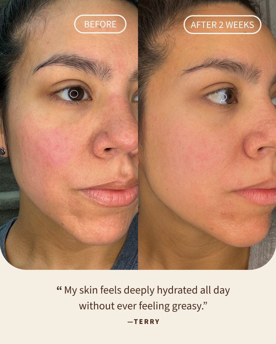 Advanced Antioxidant Renewing Gel