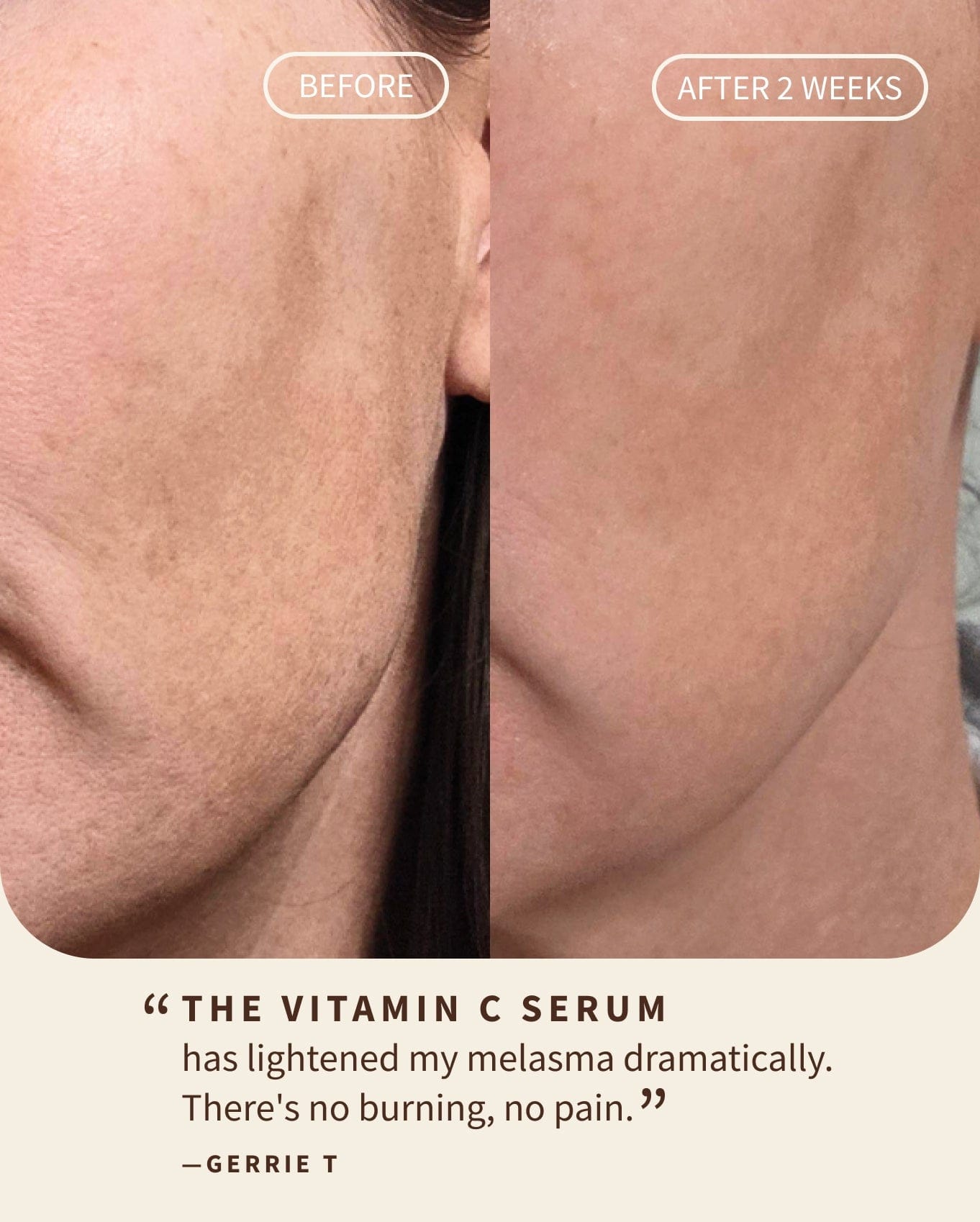 Gentle Vitamin C Glow Serum