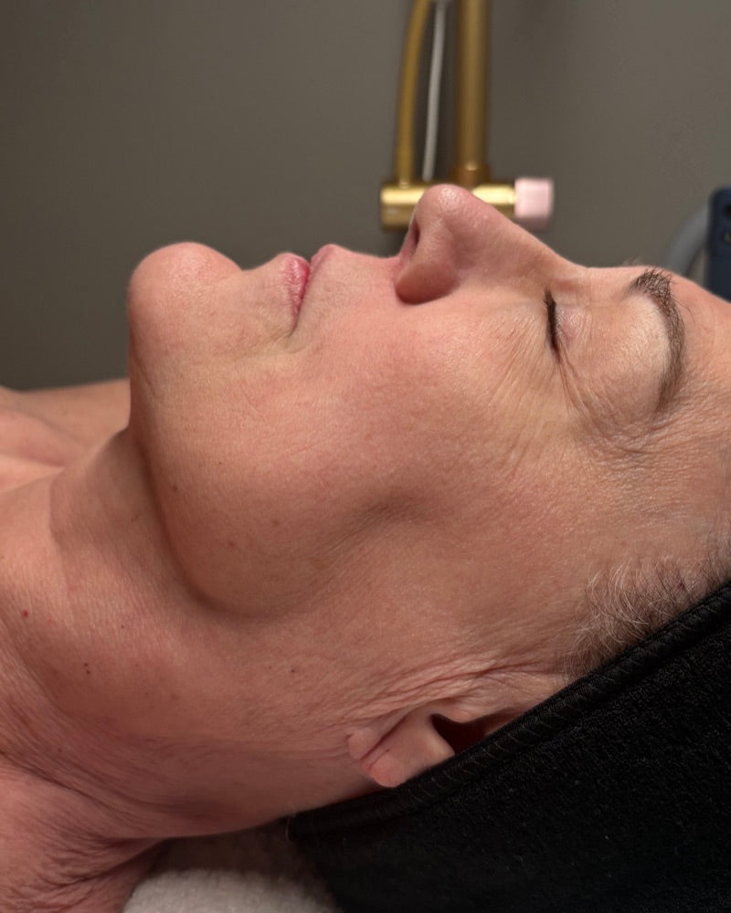 Before — 4-session series