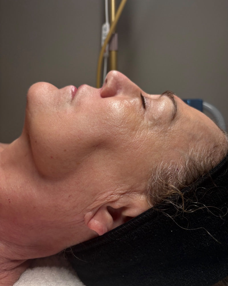 After — 4-session series