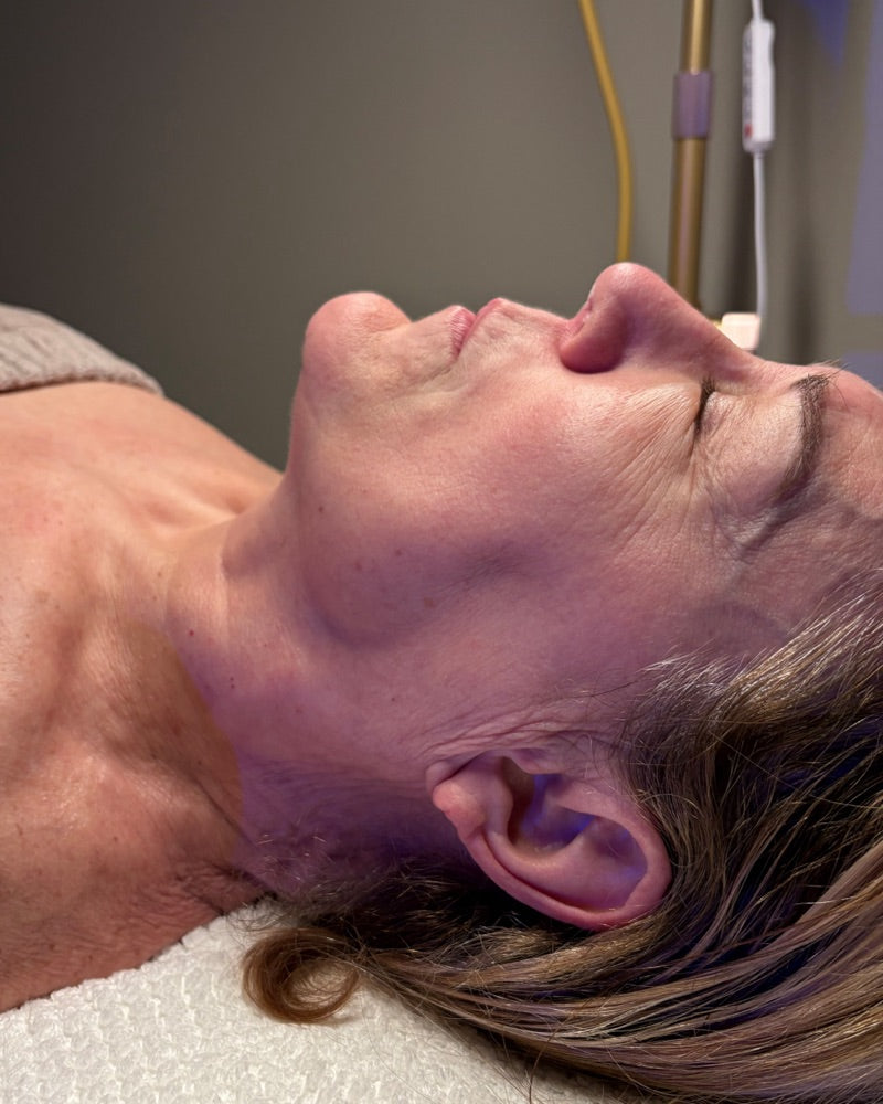Before — Firming Ritual